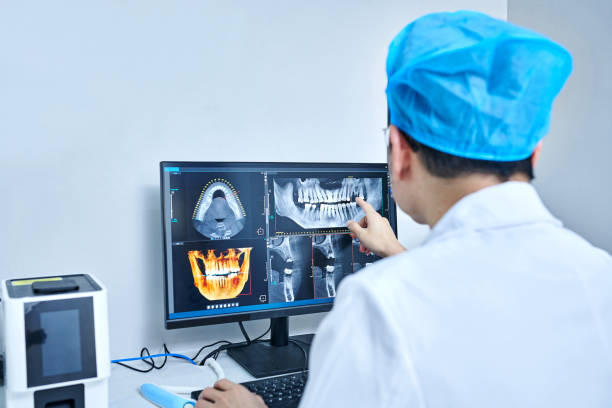 Best Emergency Wisdom Tooth Extraction in Goshen, IN